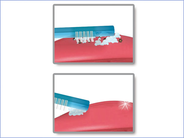 Ton Clin® Set, Zungenreiniger + 50 ml