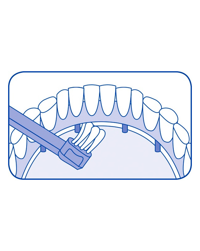 CURAPROX CS 708 Sensitive Implant Ortho im Blister